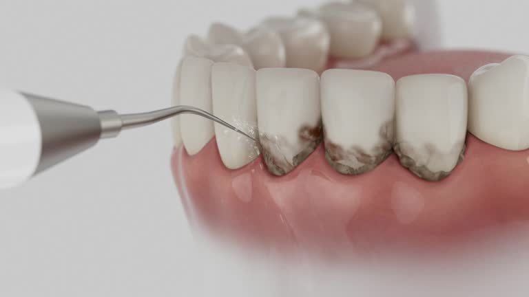 Reliable Dental Implants contractor in Rollingwood, CA by Smile Center Dentistry